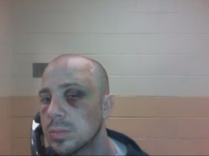 Remember The American Gulag: J6 Prisoner Savagely Beaten After Being Detained Over A Year And A Half Waiting For Trial- Denied Civil Rights